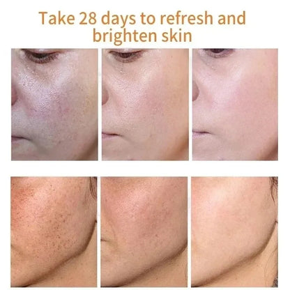 bellisse "Brighten & Even Your Skin with Fades Freckle Cream"